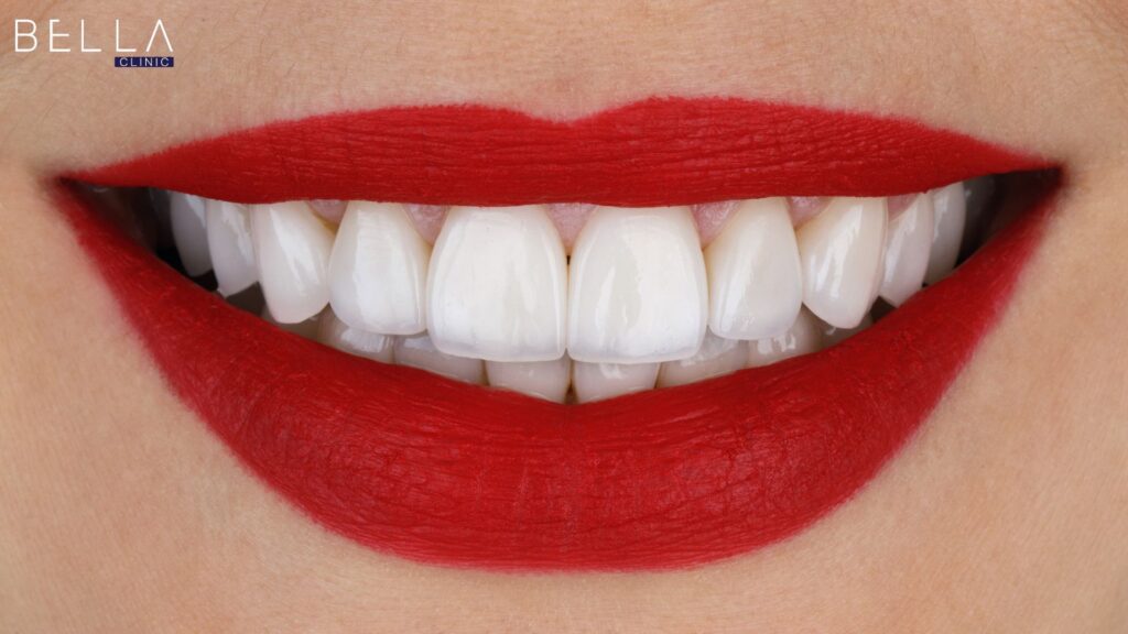 ابتسامة هوليود في تركيا