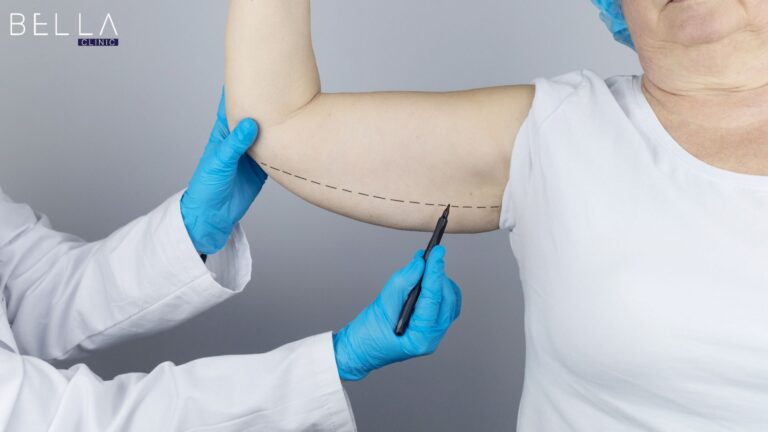 شد الذراعين في تركيا