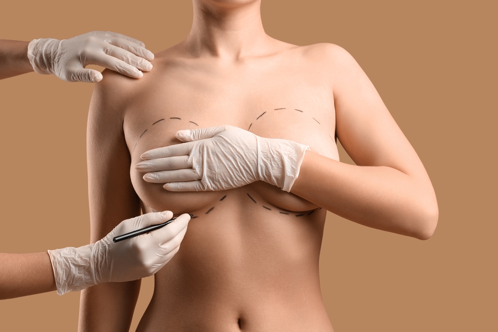 Breast Aesthetics
