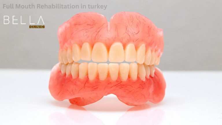 Full Mouth Rehabilitation in turkey
