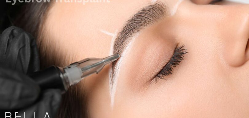 Eyebrow Transplant in turkey