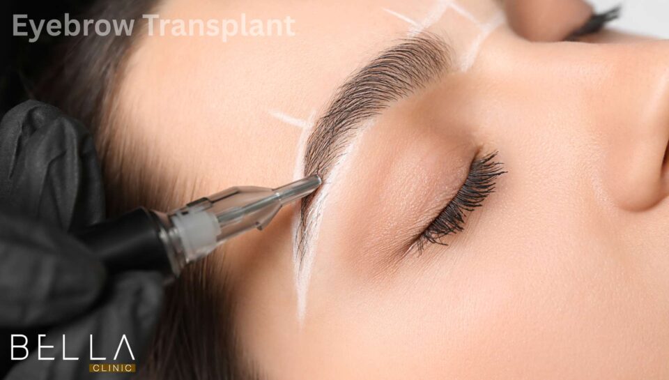 Eyebrow Transplant in turkey