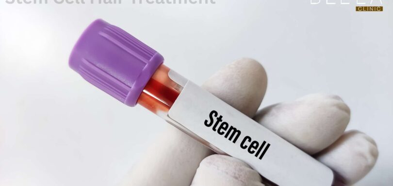Stem Cell Hair Treatment in Turkey