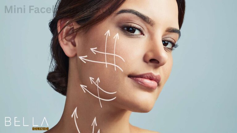 Mini Facelift in turkey