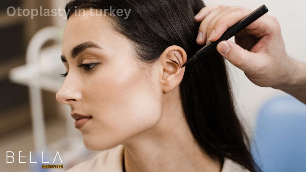 Otoplasty in turkey