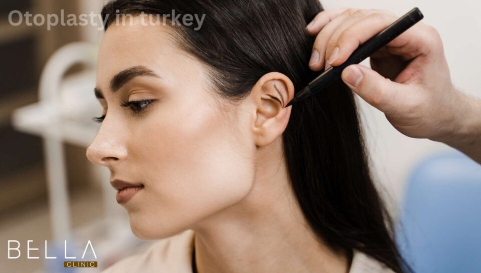 Otoplasty in turkey