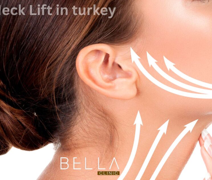 Neck Lift in turkey