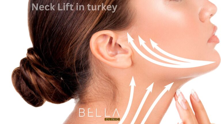 Neck Lift in turkey