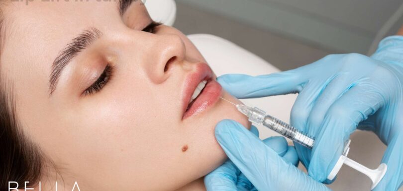 Lip Lift in turkey