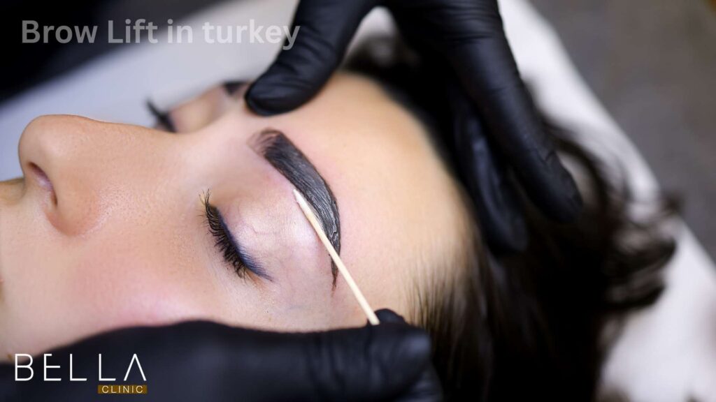 Brow Lift in turkey