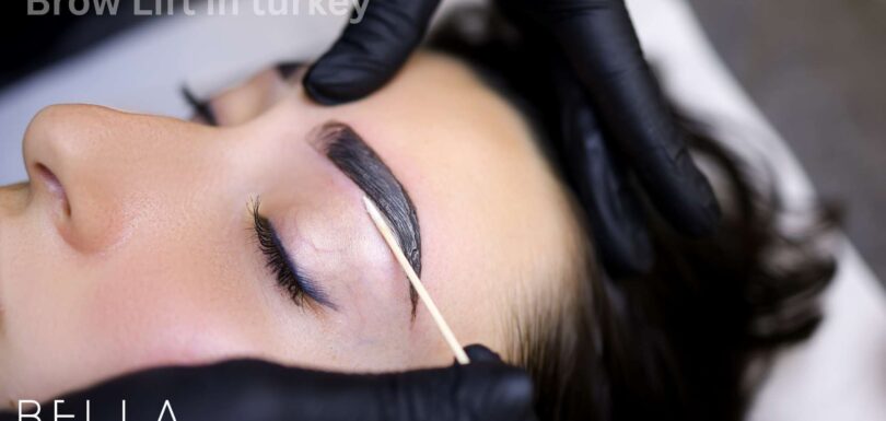 Brow Lift in turkey