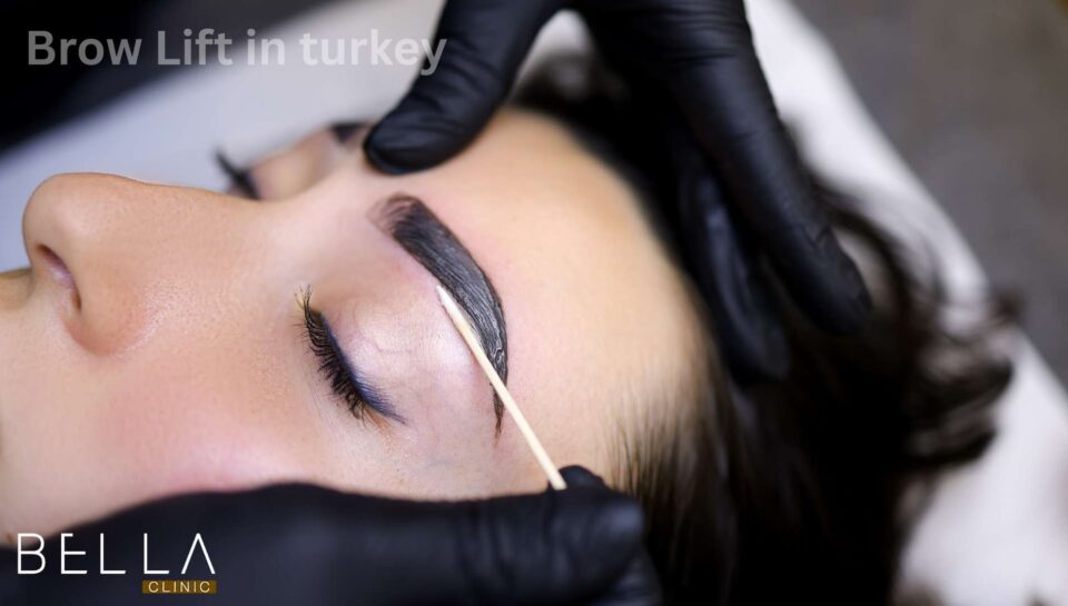 Brow Lift in turkey
