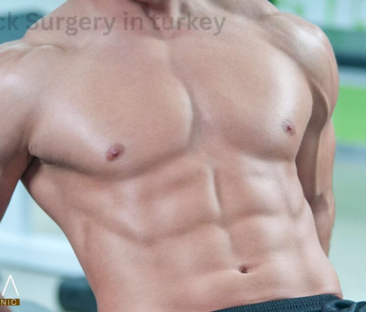 Six-Pack Surgery in turkey