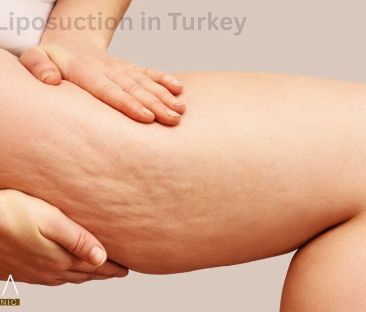 Thigh Lift in turkey