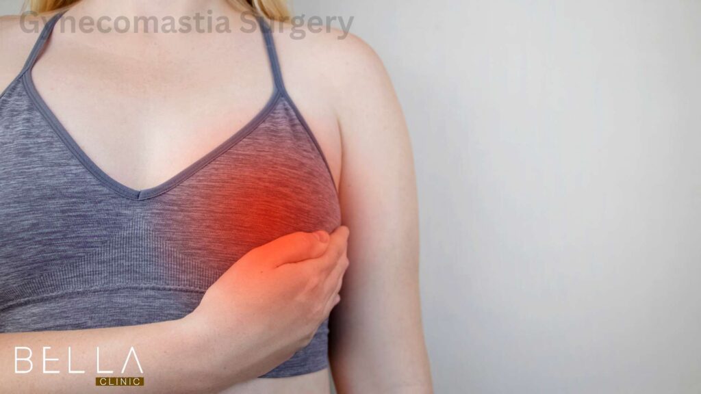 Gynecomastia Surgery