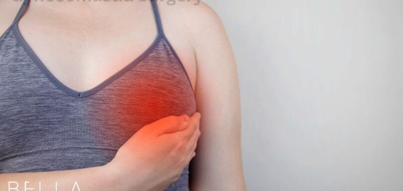 Gynecomastia Surgery