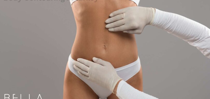 Body Contouring in turkey