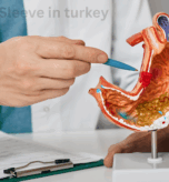 Gastric Sleeve in turkey
