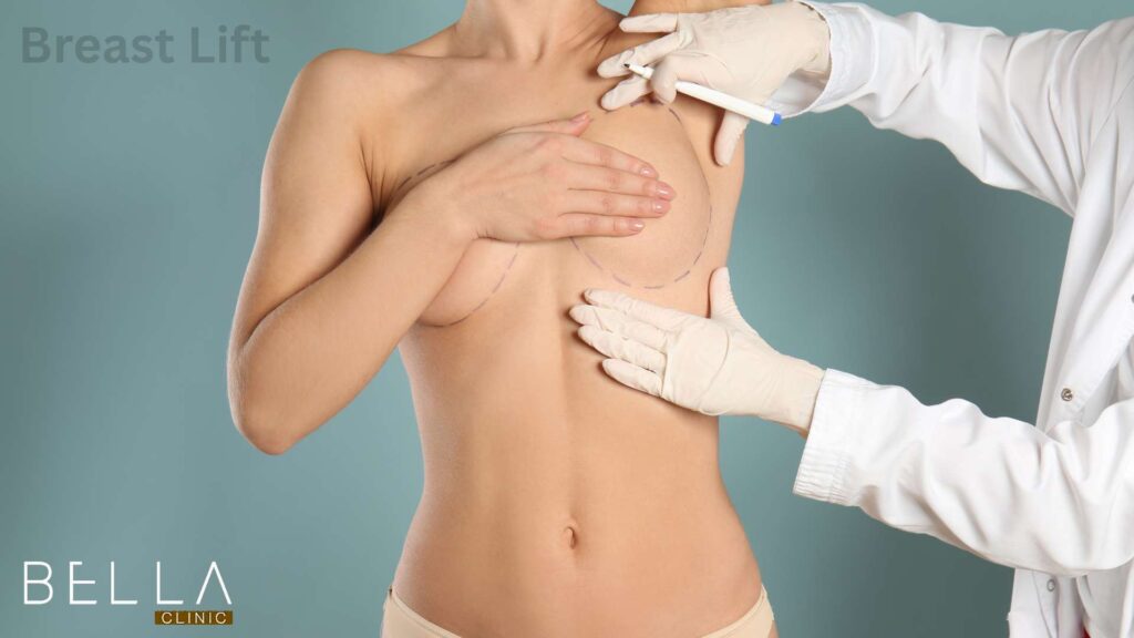 Breast Lift