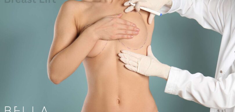 Breast Lift