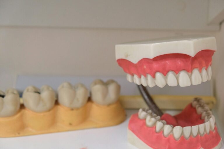Gum Contouring in turkey 2025