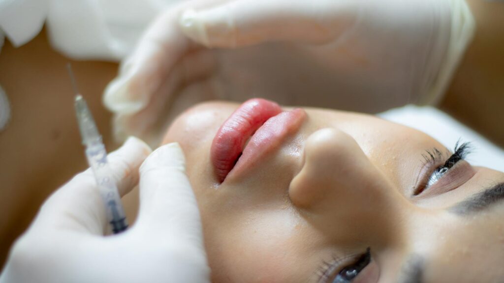 Lip Lift in turkey cost near me before and after