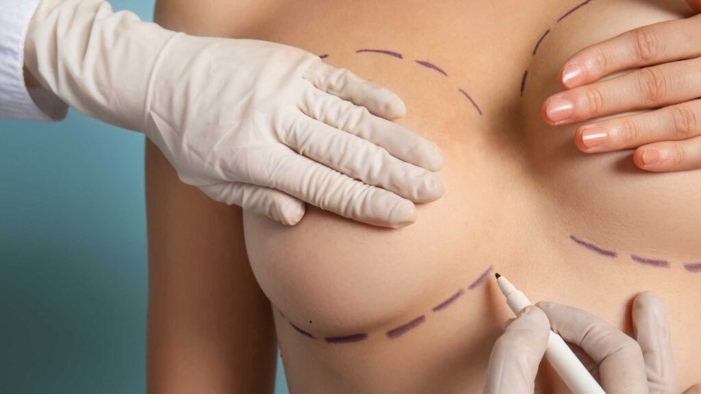Breast Augmentation Surgeons Near Me