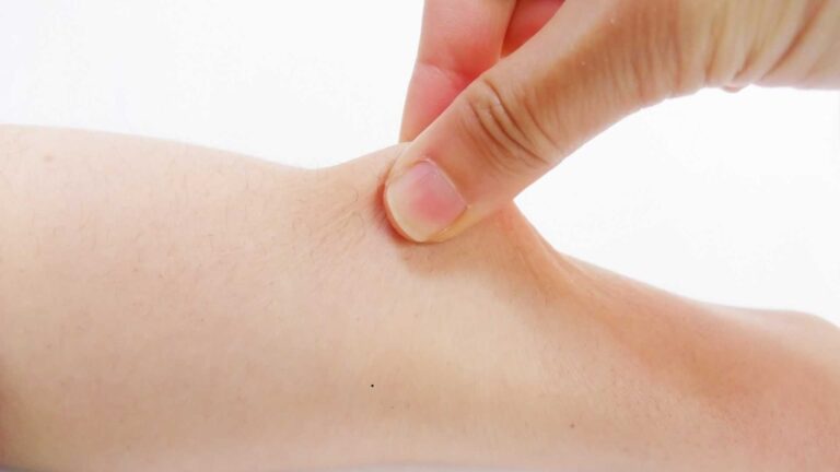 Arm Lift in Turkey Cost