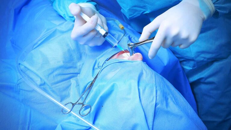 Best Doctor for Rhinoplasty in Turkey
