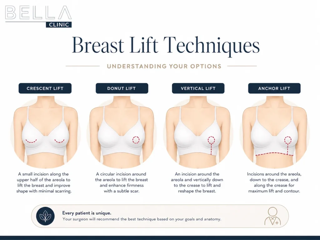 Comparison of crescent, donut, vertical and anchor breast lift techniques