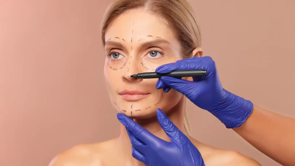 3D medical illustration showing correction of a deviated septum together with reshaping of the external nasal structure.