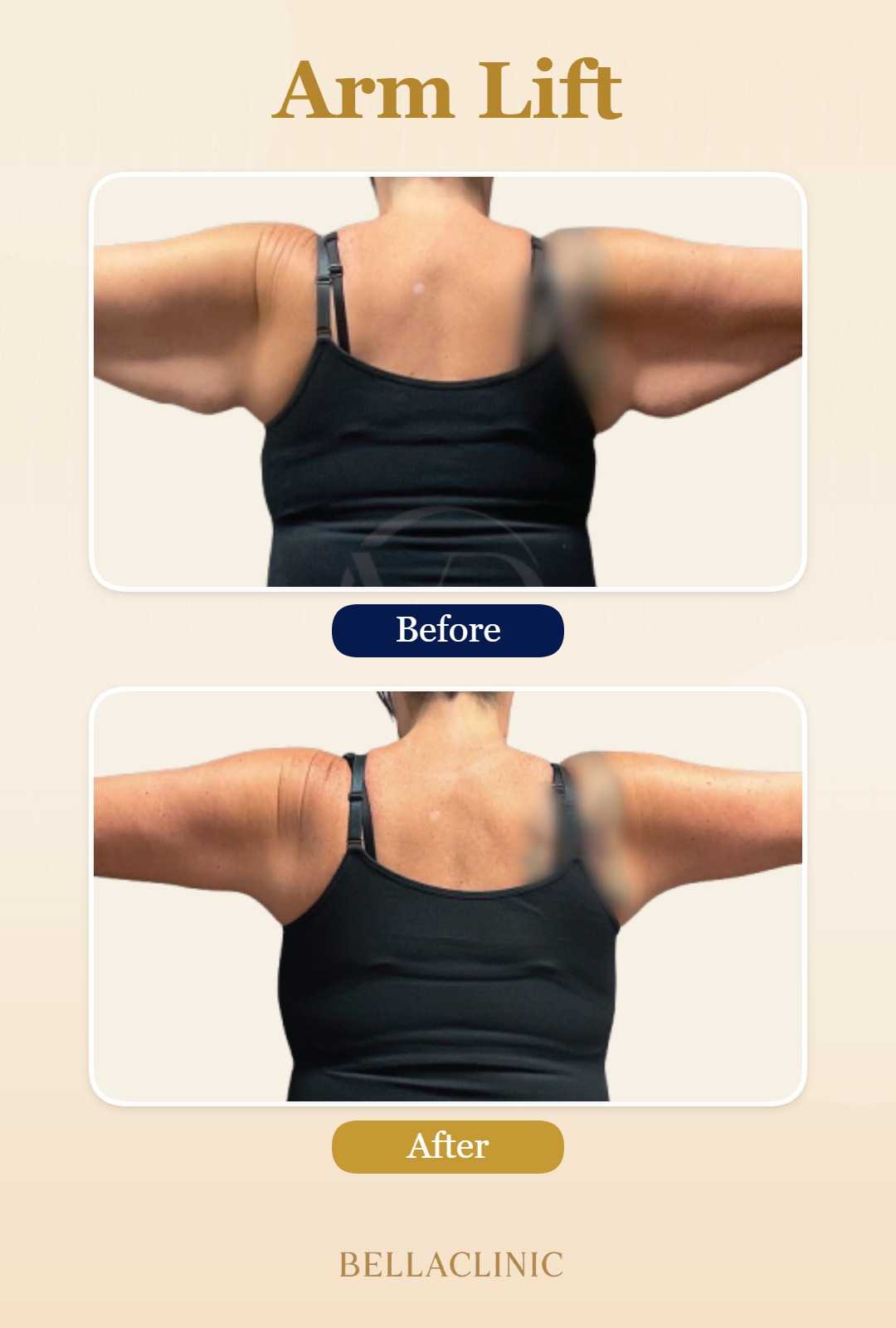 before-after-20260720-165206-vGo7Mk.jpg