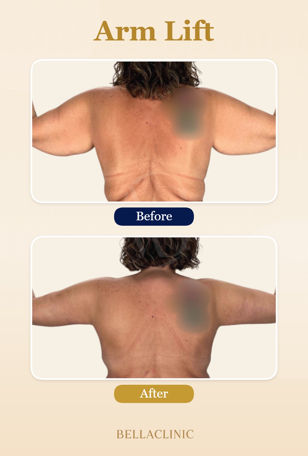 before-after-20260720-165358-kRaCnw.jpg