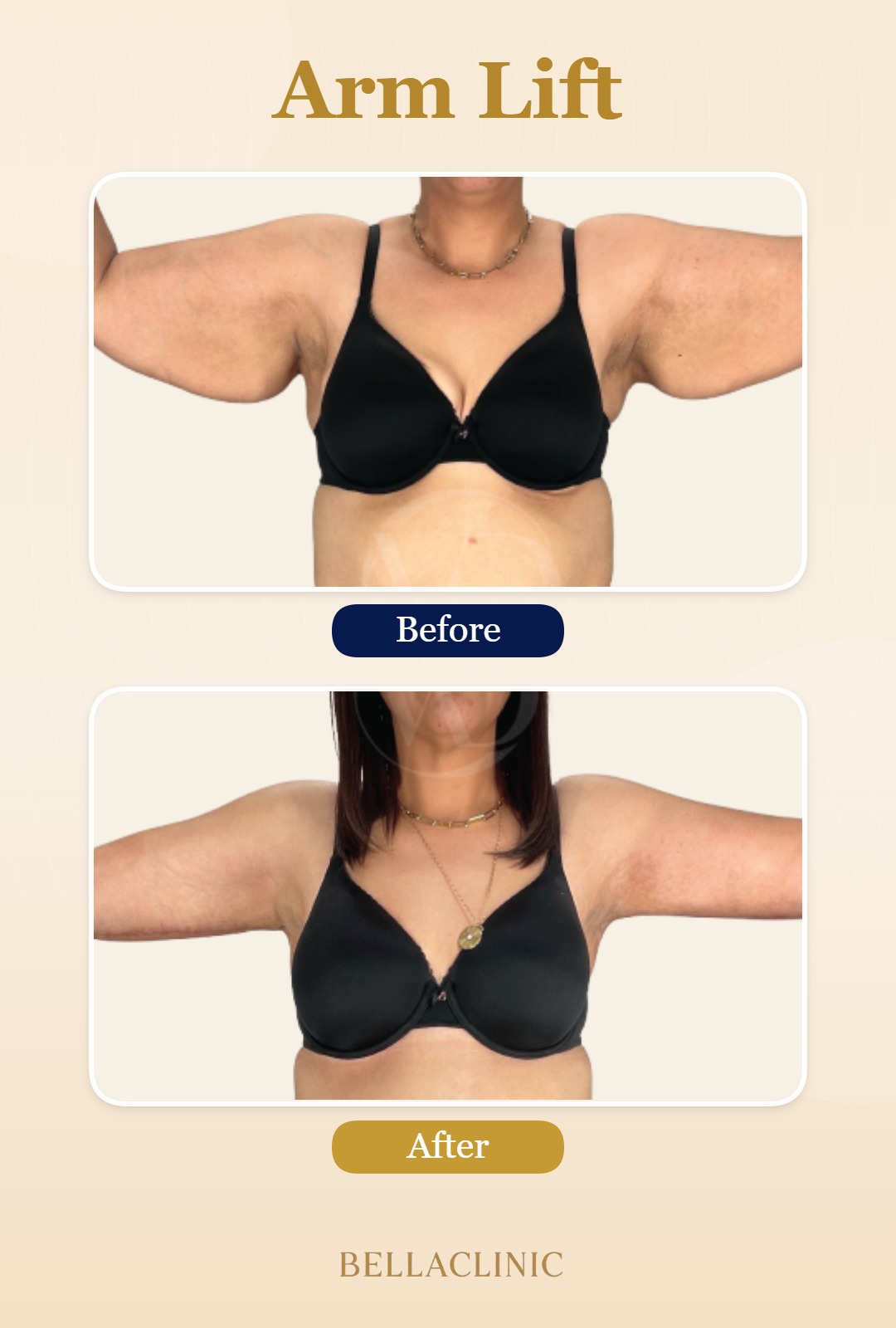 before-after-20260720-165524-BpULsI.jpg