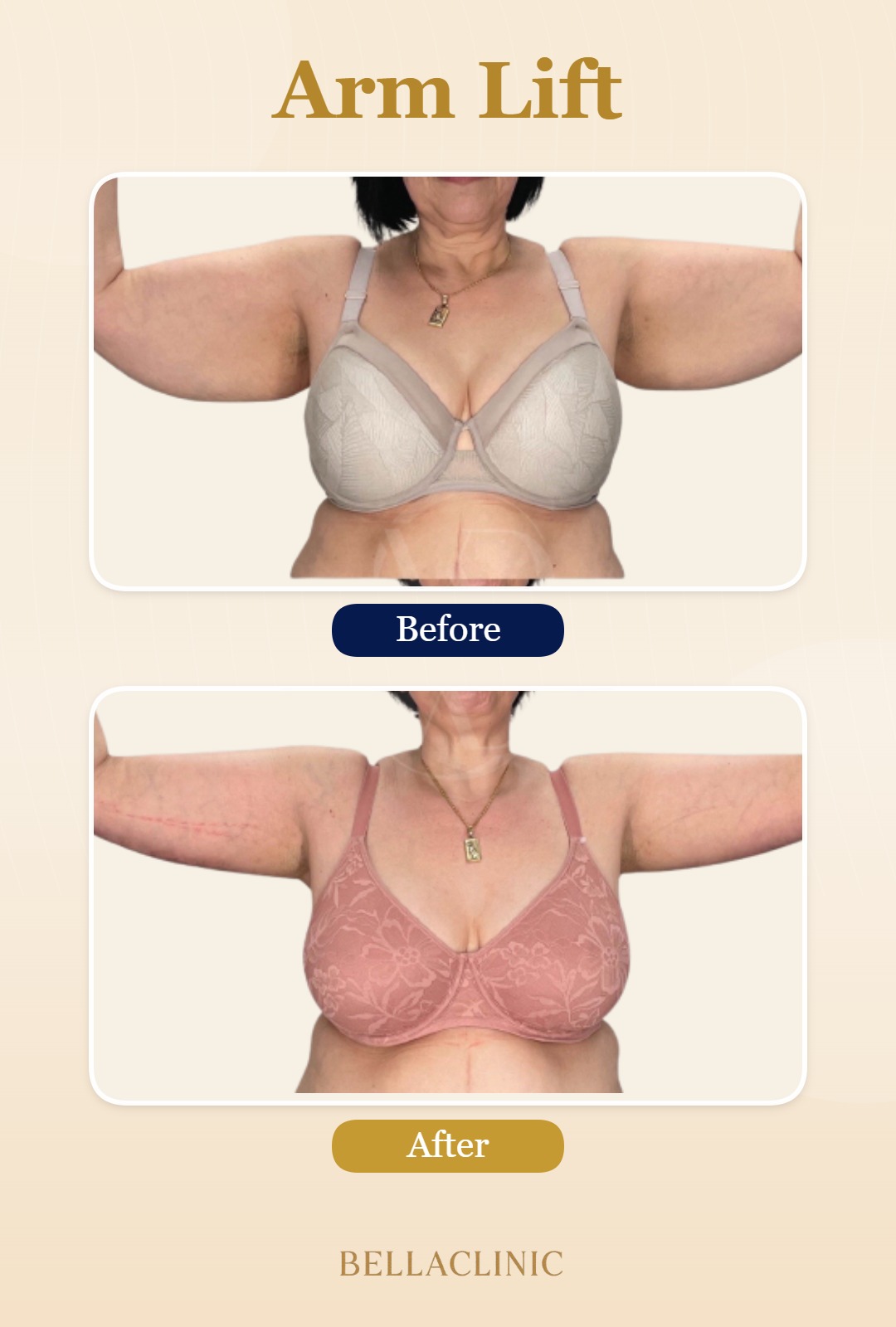 before-after-20260720-165709-9KJGeV.jpg
