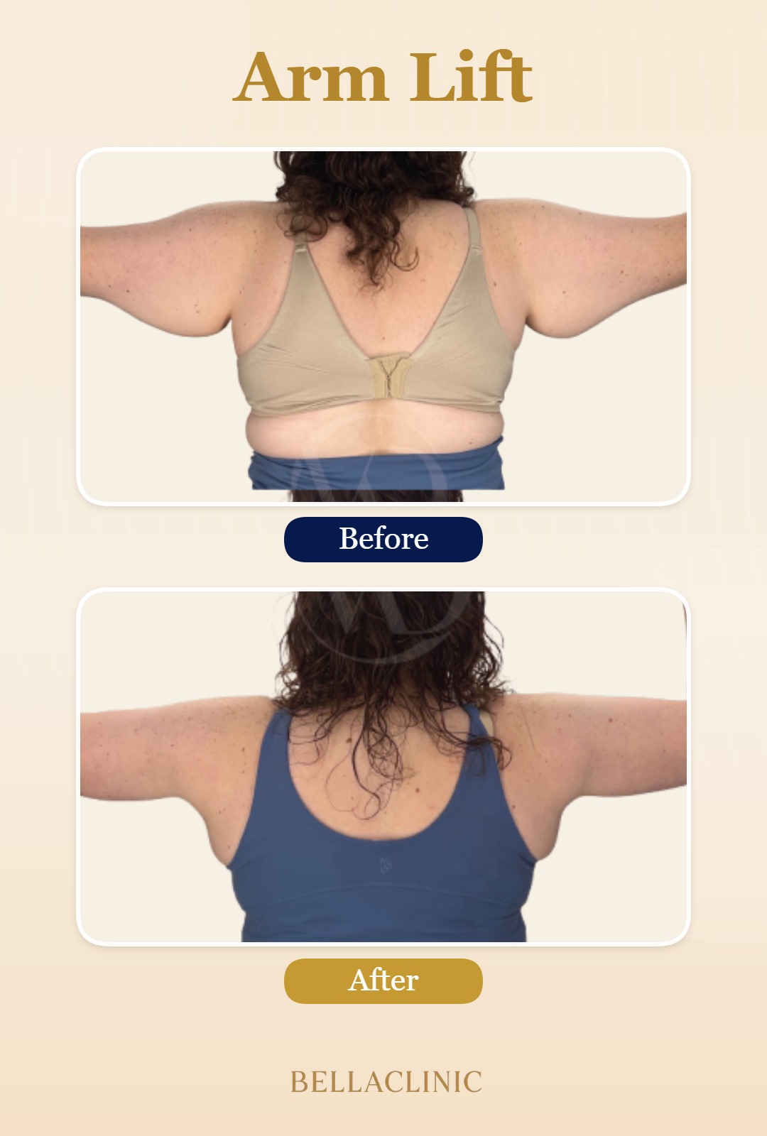 before-after-20260720-165815-Jc9iLz.jpg