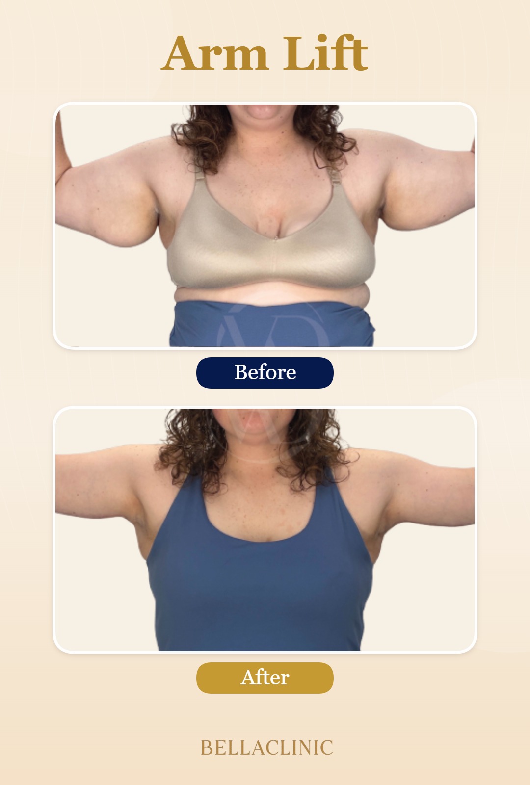 before-after-20260720-165945-gObBWN.jpg