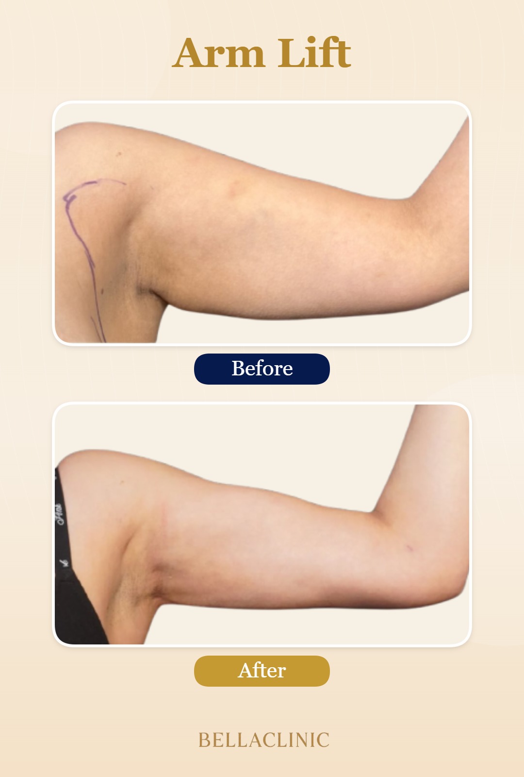 before-after-20260720-171458-mhfiQE.jpg