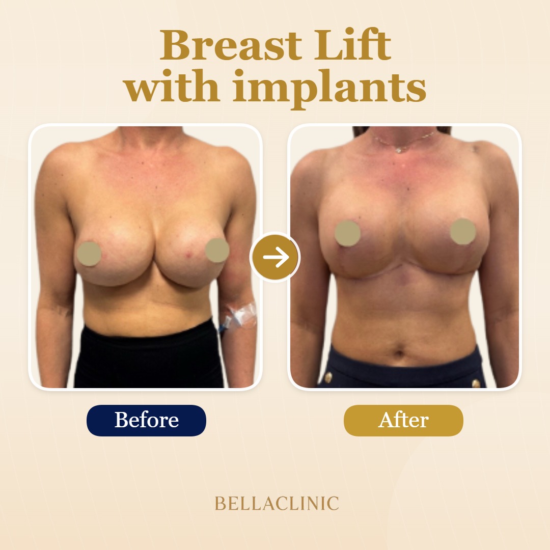 before-after-20260721-154044-IYARgM.jpg