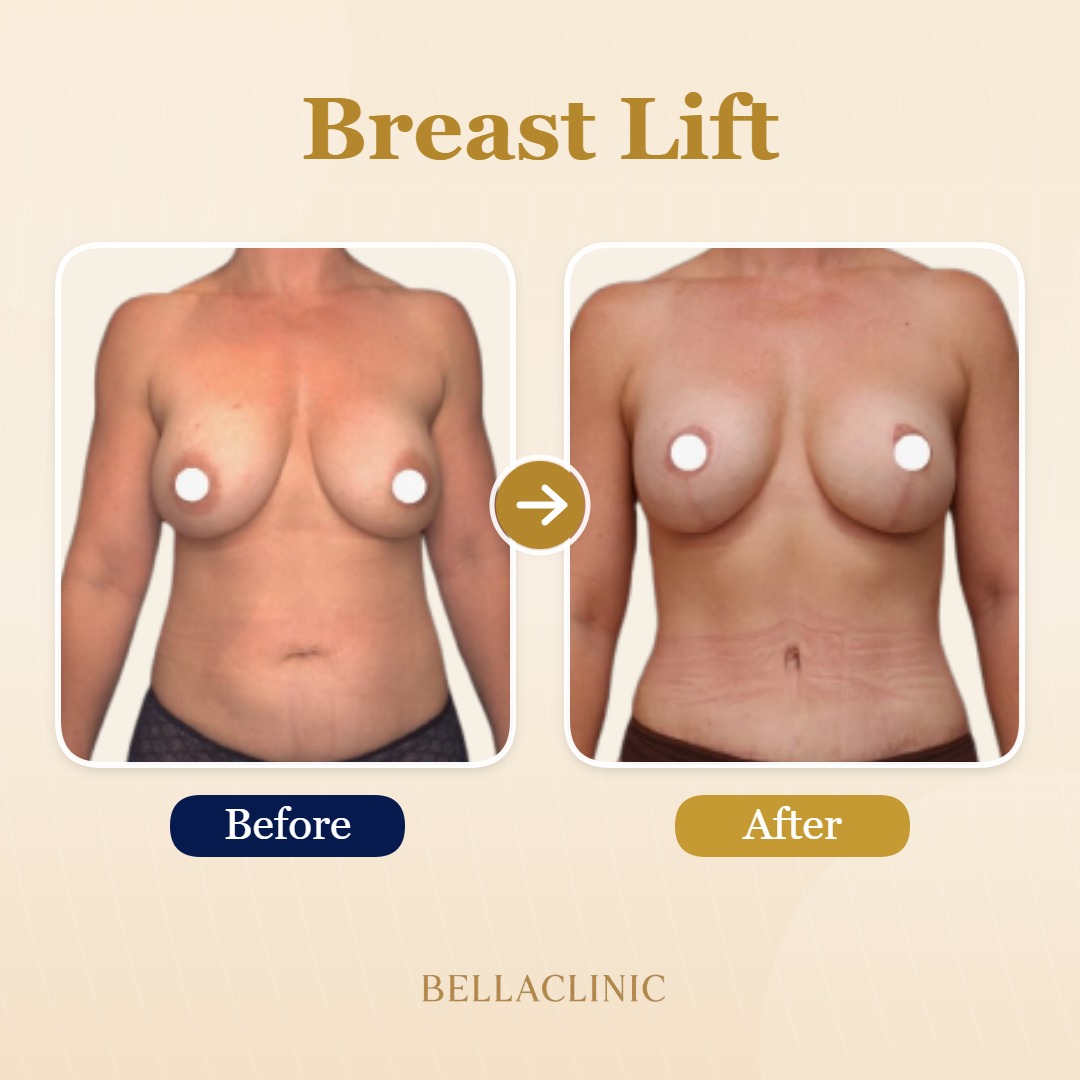 before-after-20260720-170641-Lhy8wt.jpg