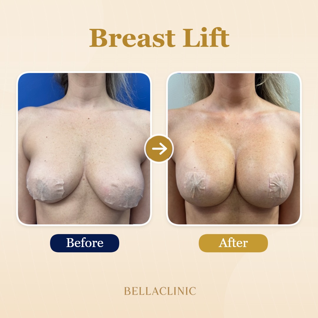before-after-20260720-171229-UXko9a.jpg
