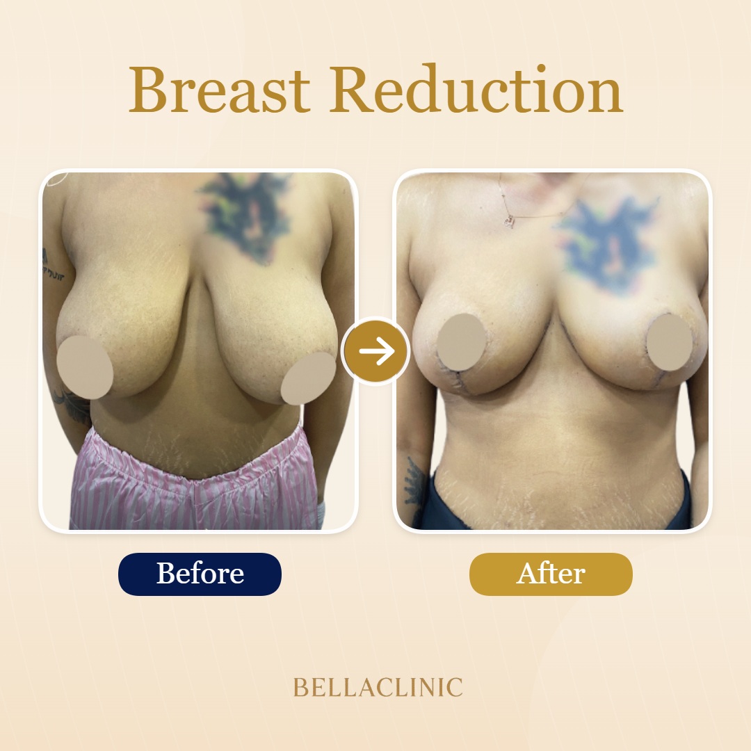 before-after-20260611-143757-Eus4gq.jpg