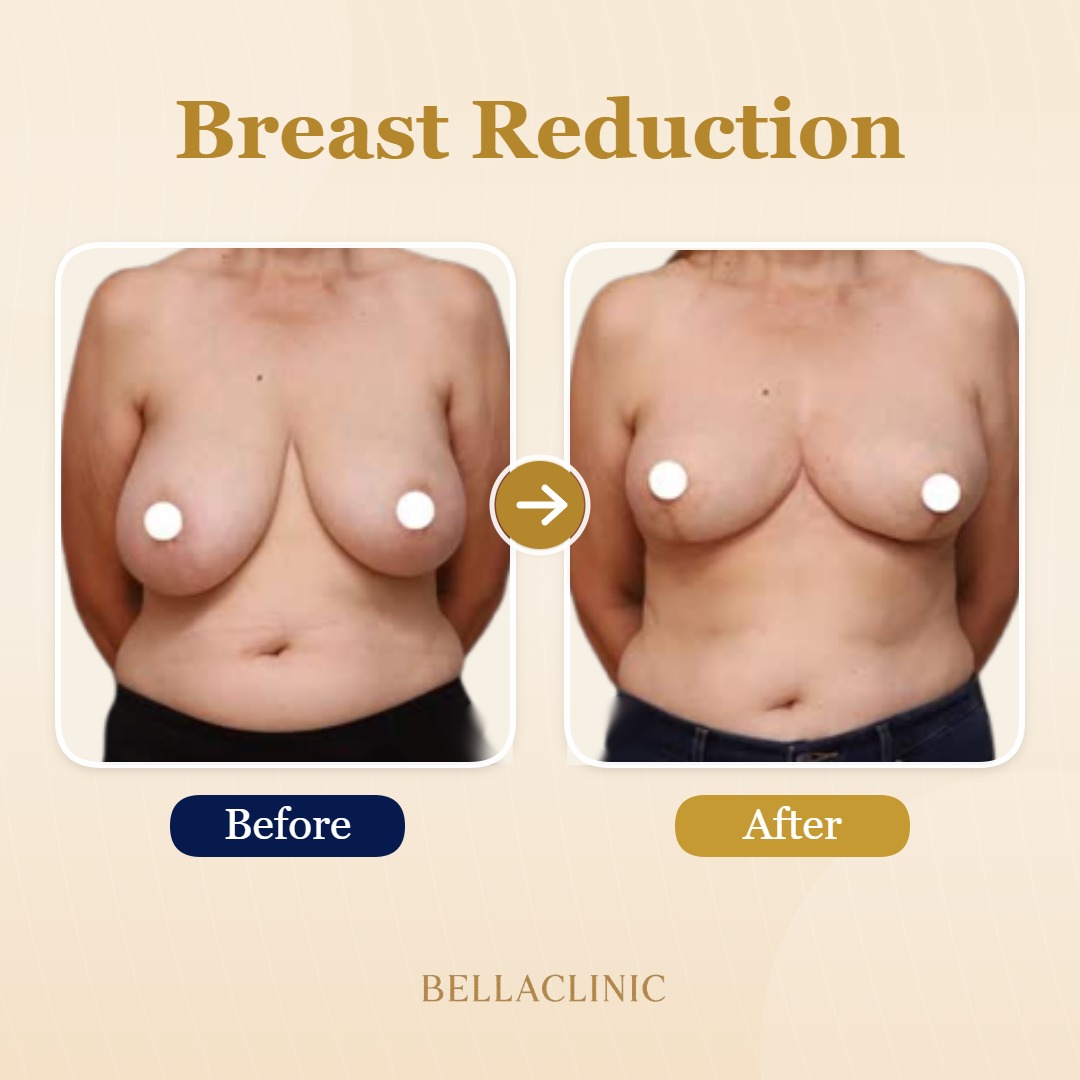 before-after-20260720-170507-3ETqAT.jpg