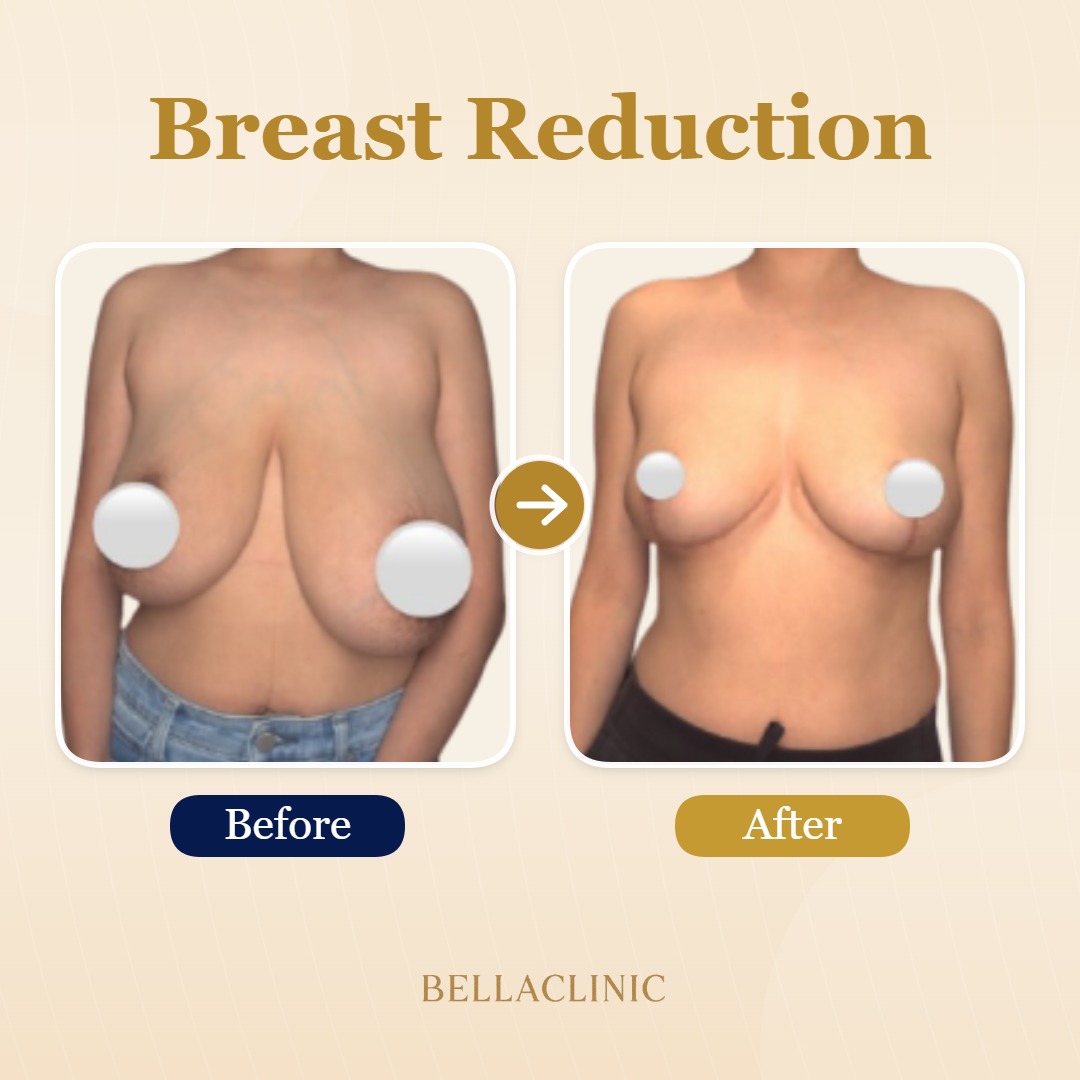 before-after-20260721-225252-GmYg3v.jpg