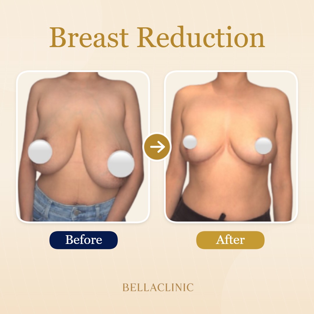 before-after-20260721-231354-sEeOAy.jpg