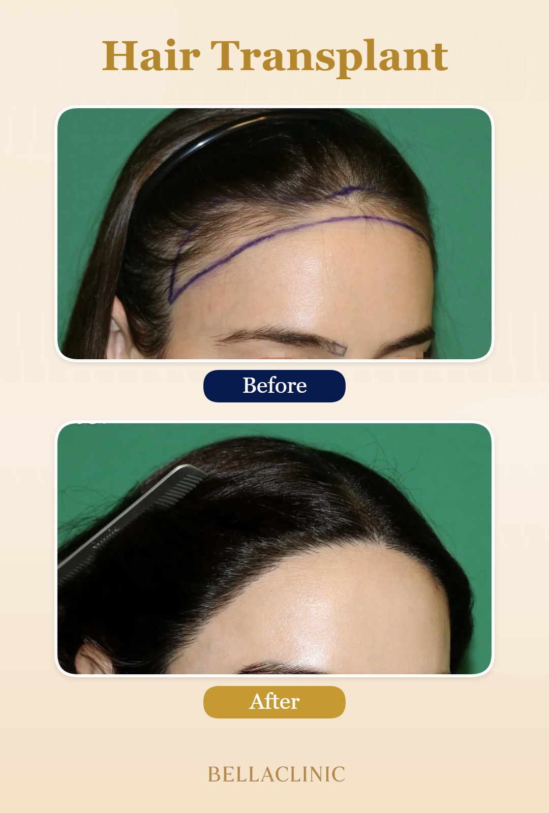 before-after-20260804-223756-2n04ZU.jpg