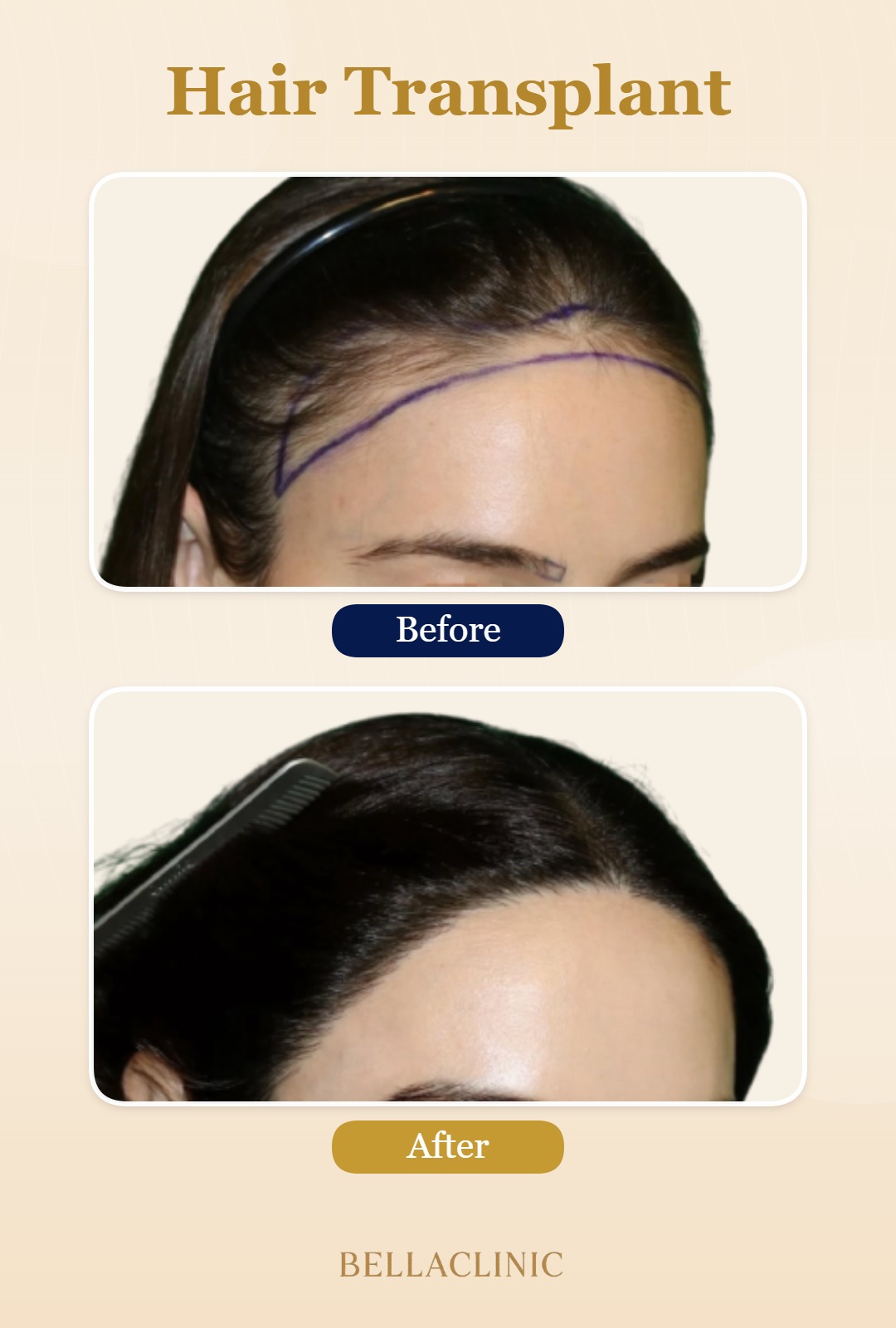 before-after-20260804-223810-DgWU8z.jpg