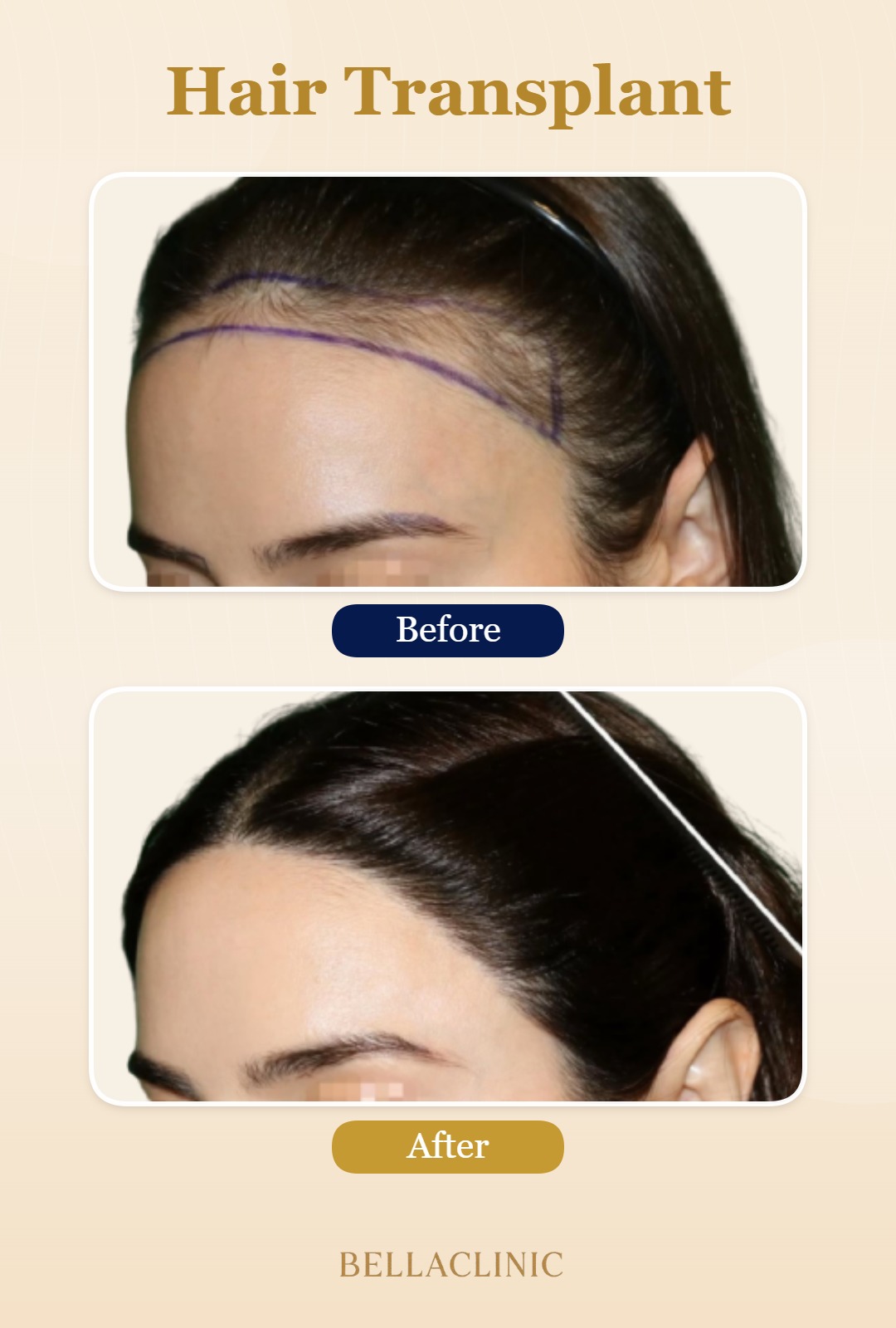 before-after-20260804-223853-NXydXC.jpg