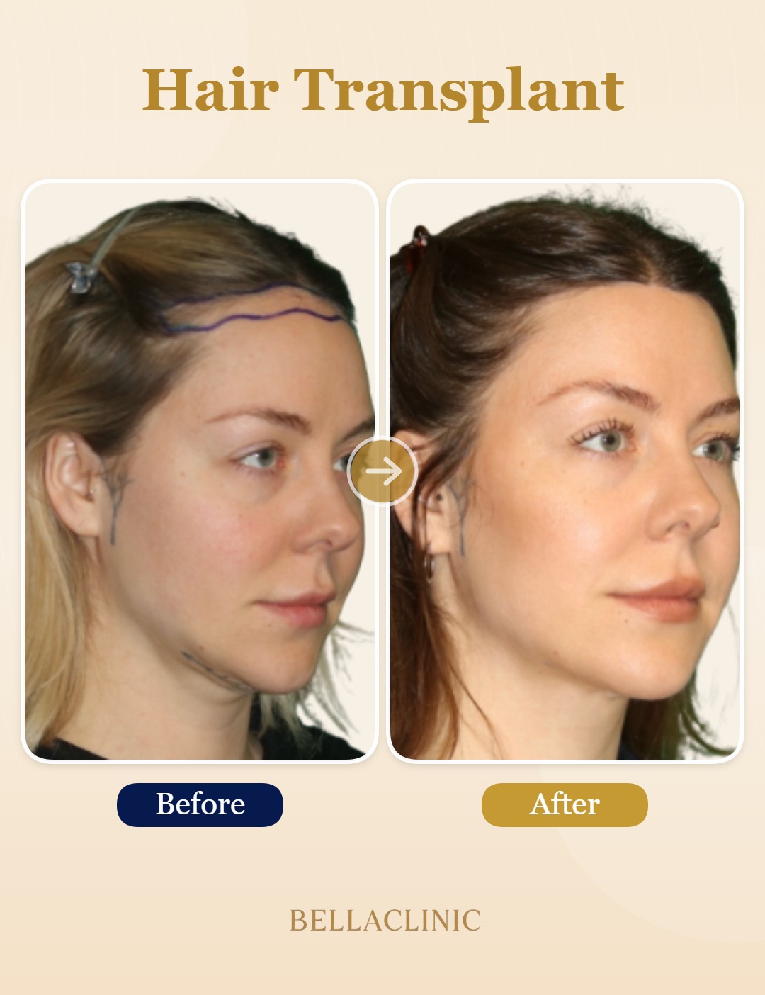before-after-20260804-224005-mkDsNx.jpg