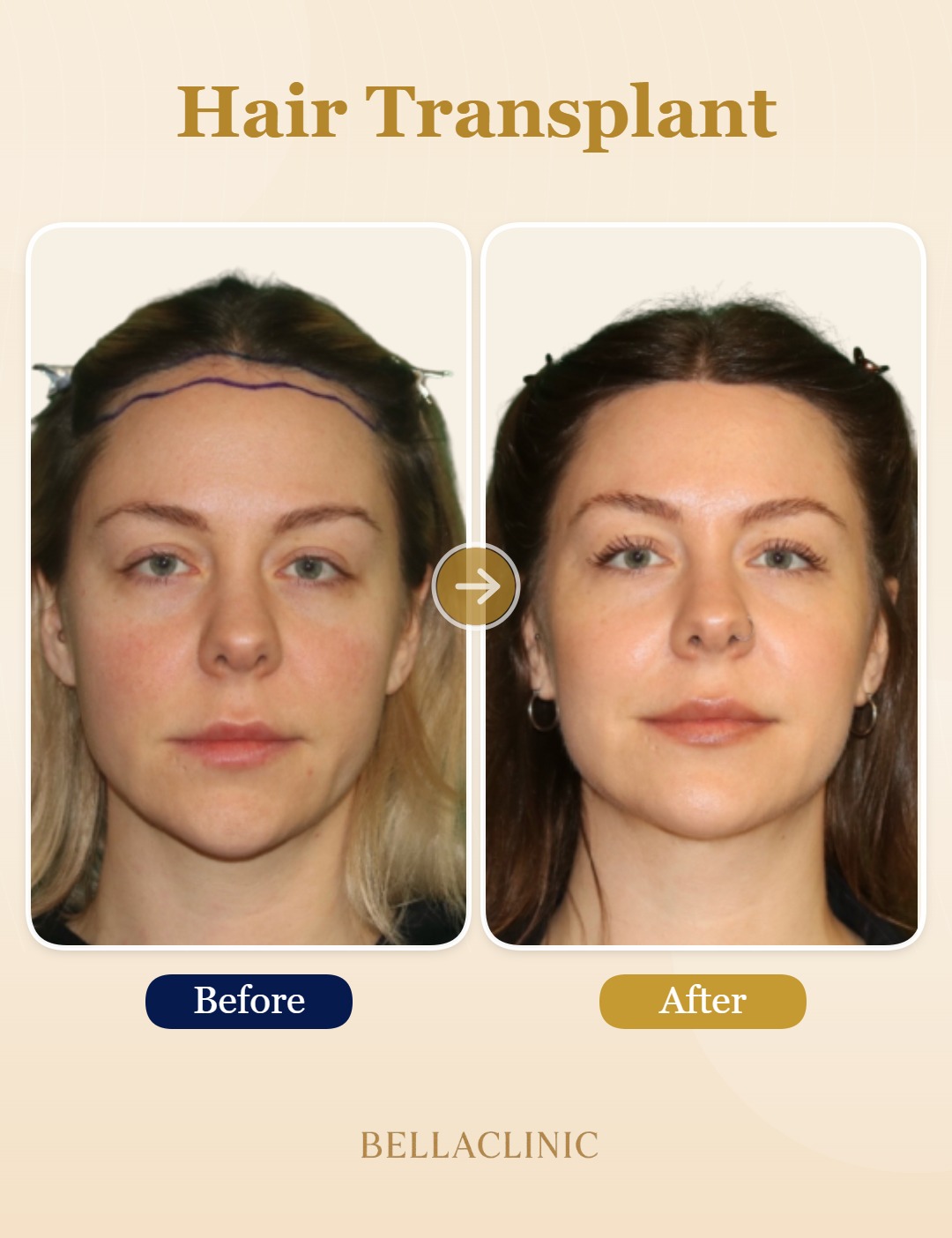 before-after-20260804-224136-6MTNoT.jpg